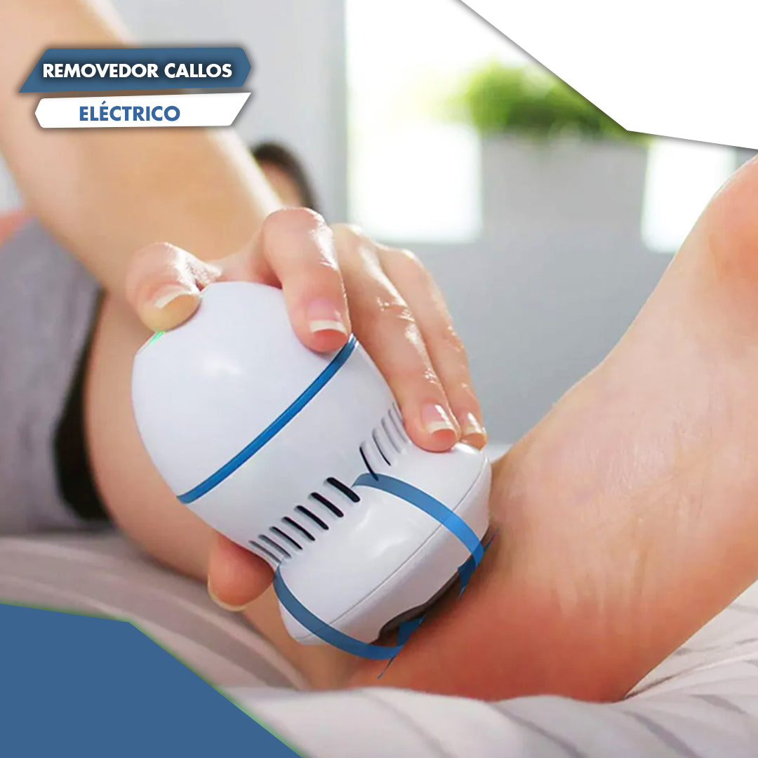 Removedor Eléctrico Para Callos Recargable - Pies suaves desde el primer uso